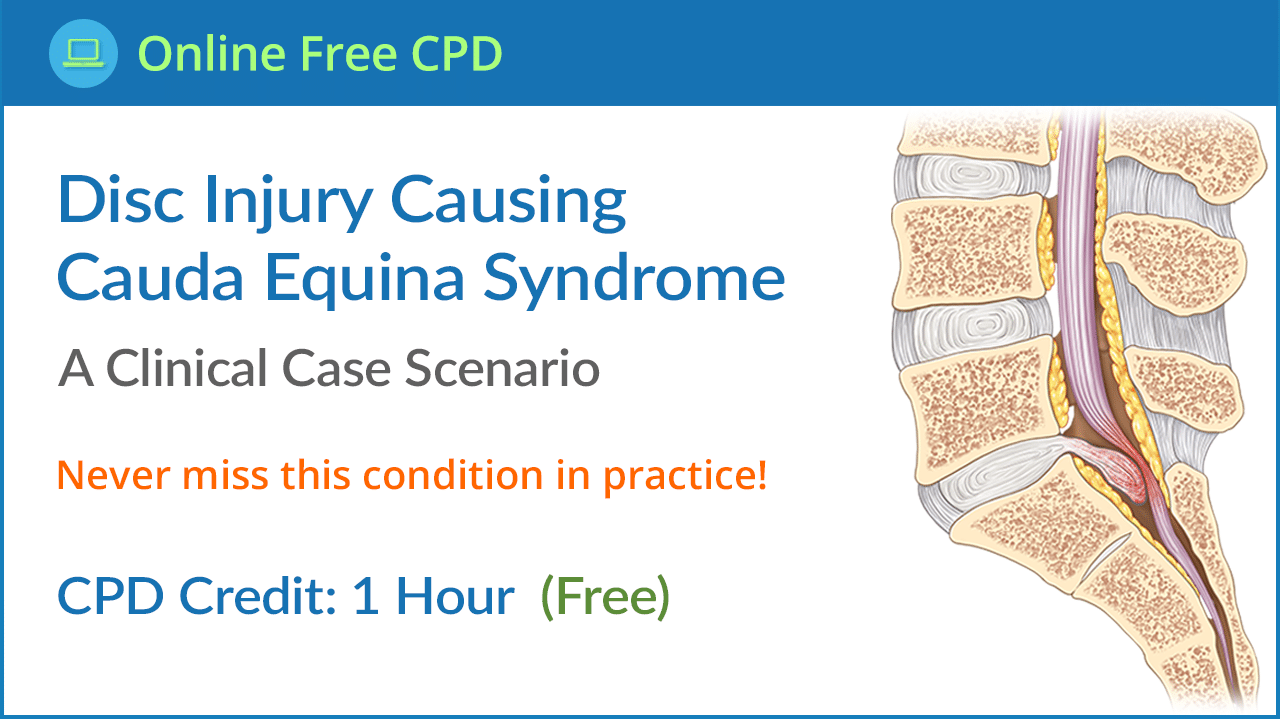 Disc Injury Causing Cauda Equina Syndrome Disc Injury Causing Cauda Equina Syndrome