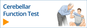 Cerebellar Function Test