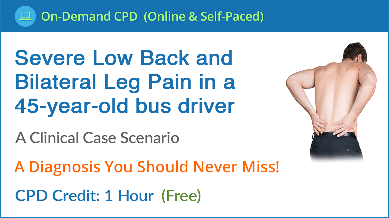 Disc Injury Causing Cauda Equina Syndrome Disc Injury Causing Cauda Equina Syndrome