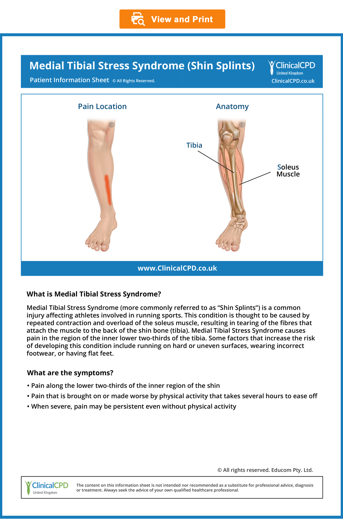 Shin Splints-Medial Tibial Stress Syndrome-CPD