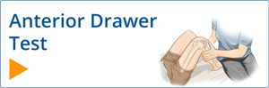 Anterior Drawer Test