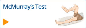 McMurray’s test