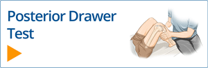 Posterior Drawer test