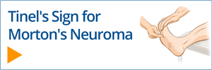 Tinel's Sign - Morton's Neuroma