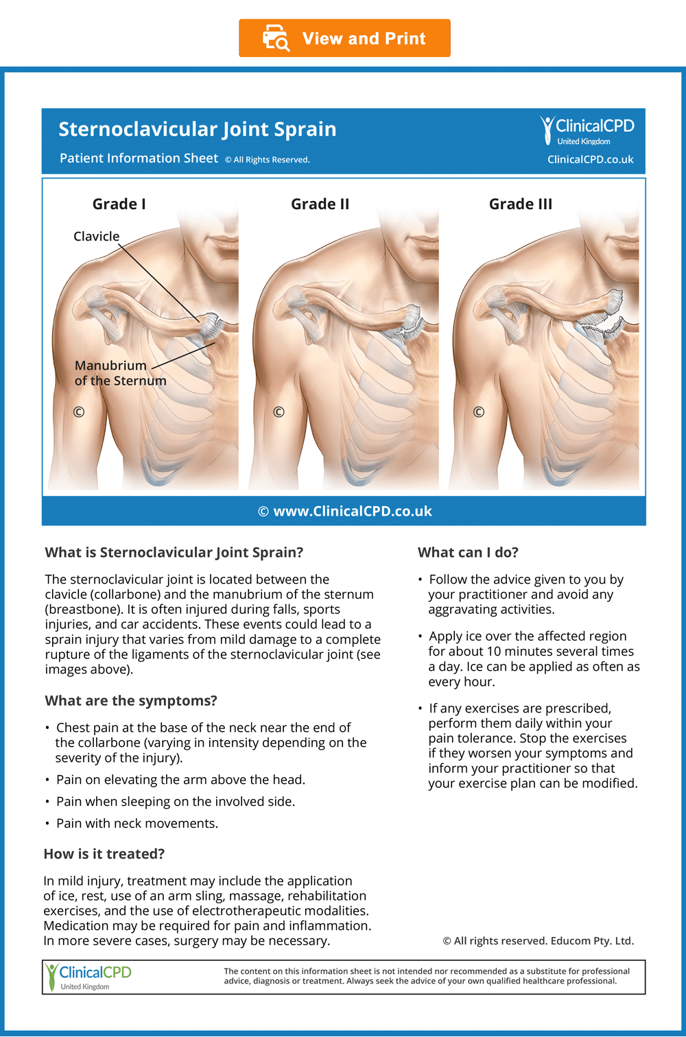 Sternoclavicular-Joint-Sprain-CPD